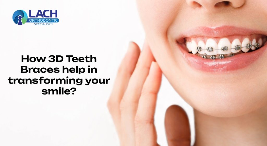 3D Teeth Braces