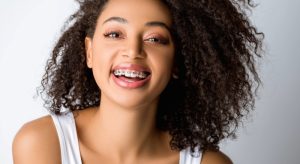 3d teeth braces