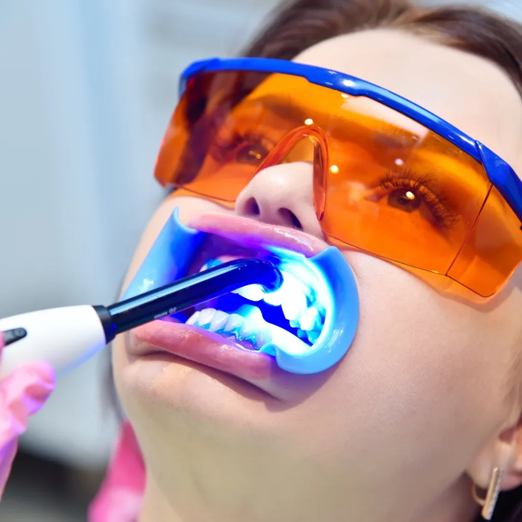 Best way to whiten teeth (2)