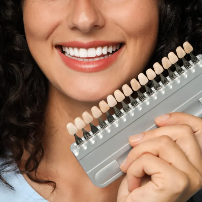 Book dental veneers