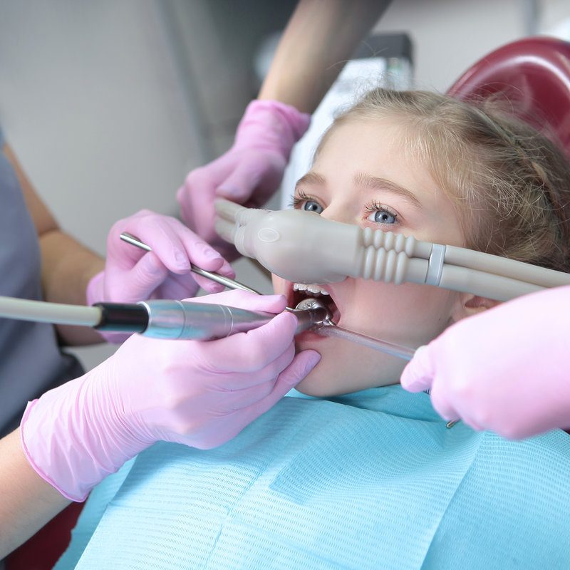 Dental treatment in a child with the use of nitrous oxide. Relaxation of the patient before surgical or dental procedures.