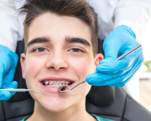 Affordable orthodontics oviedo