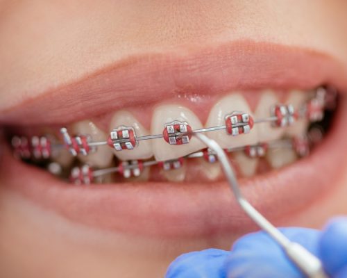 Orthodontist for adults