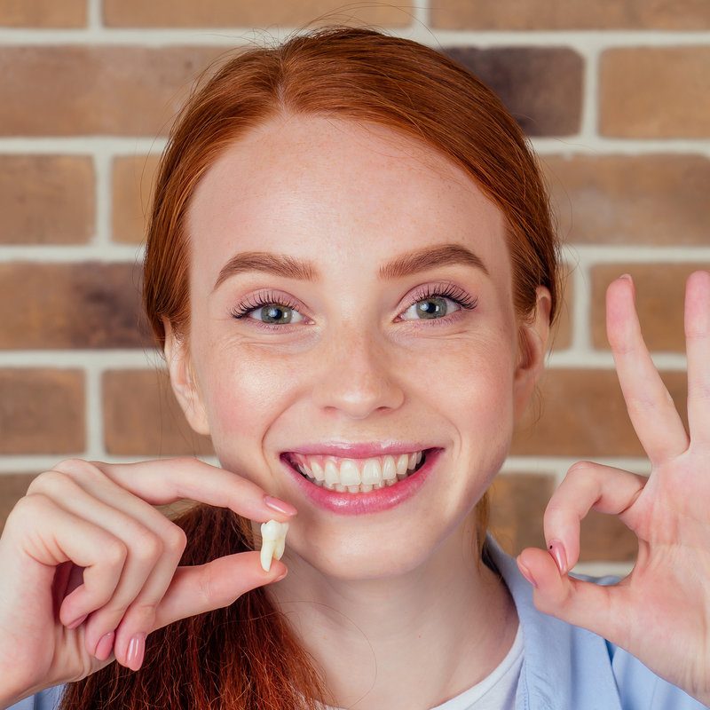 Redhaired ginger female with snow white smile holding white wisdom tooth after surgery removal of a tooth